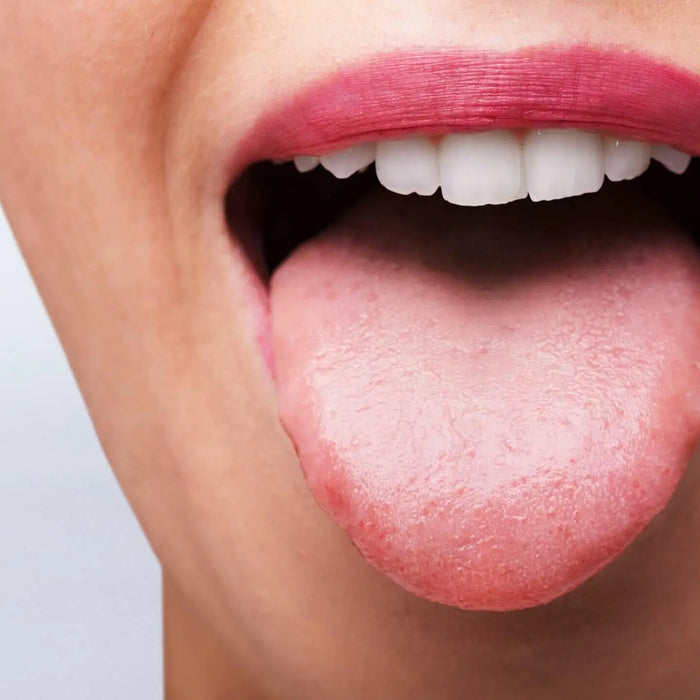 Candida: Why It's an Immune Problem, Not an Overgrowth Problem