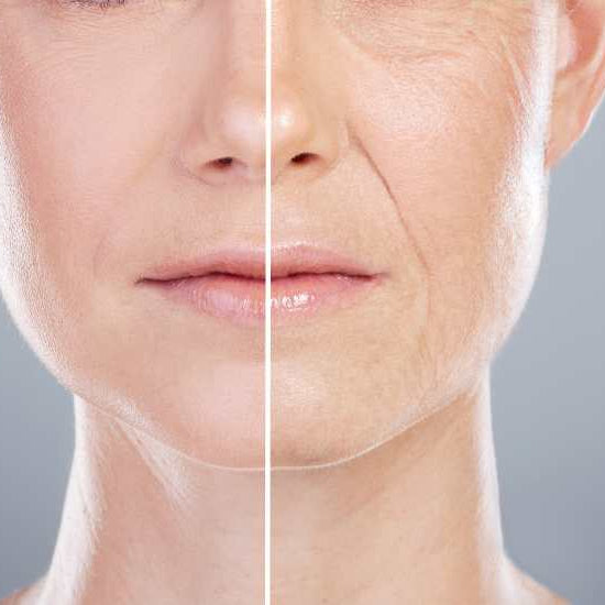Why Collagen Alone Won't Save Your Skin - And What Might.....The Hidden Forces Behind Facial Ageing—And What Actually Works