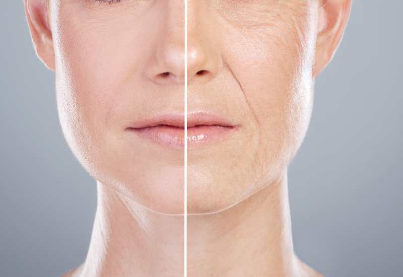 Why Collagen Alone Won't Save Your Skin - And What Might.....The Hidden Forces Behind Facial Ageing—And What Actually Works